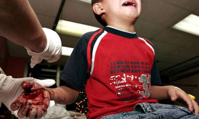 Florencio Varela: un menor herido por el uso de pirotecnia durante los festejos por Año Nuevo
