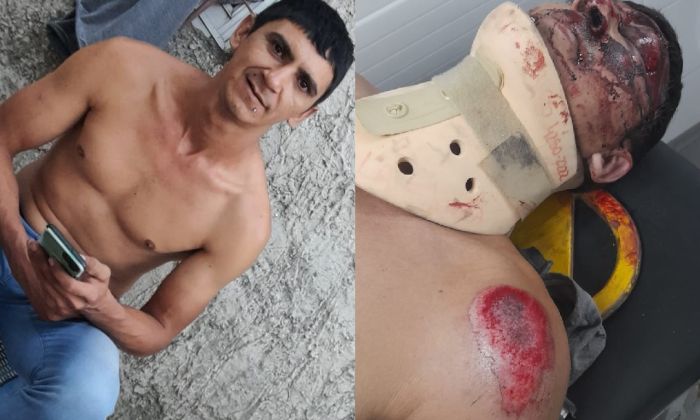 Solano: Atropelló a motociclista y se dio a la fuga. Buscan testigos