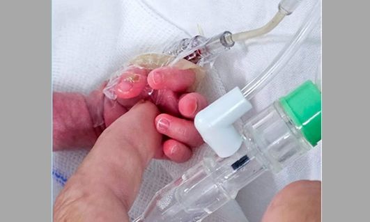 Cirujanos del HEC operaron del corazón a un bebé prematuro, en el Hospital Evita de Lanús