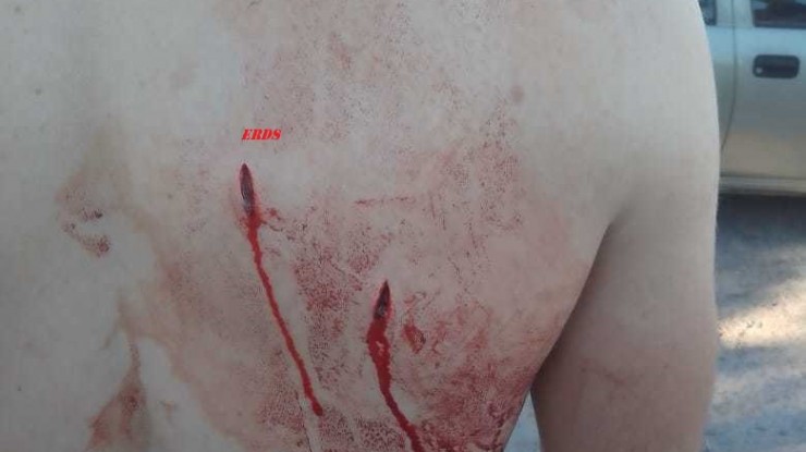 Un hombre fue atacado a puñaladas por su ex pareja